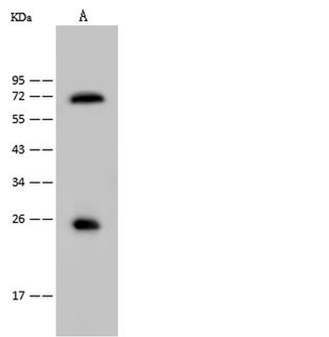 Sostdc1 Antibody in Western Blot (WB)