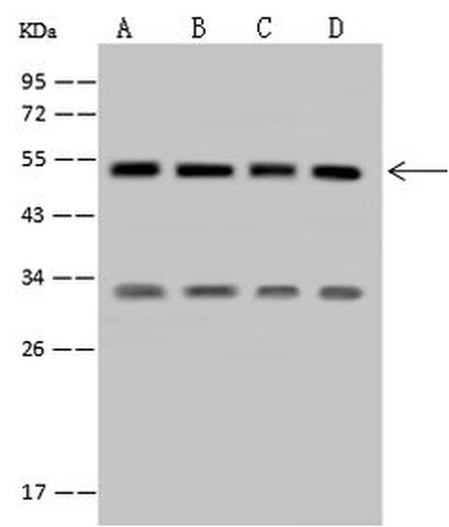 SETD8 Antibody in Western Blot (WB)