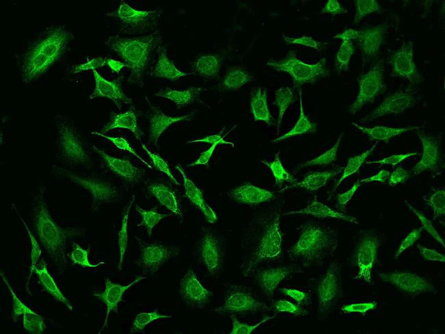 PSPH Antibody in Immunocytochemistry (ICC/IF)