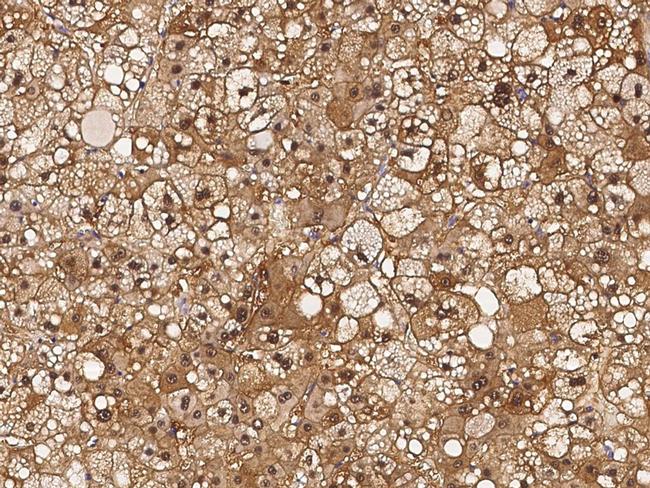 RBKS Antibody in Immunohistochemistry (Paraffin) (IHC (P))