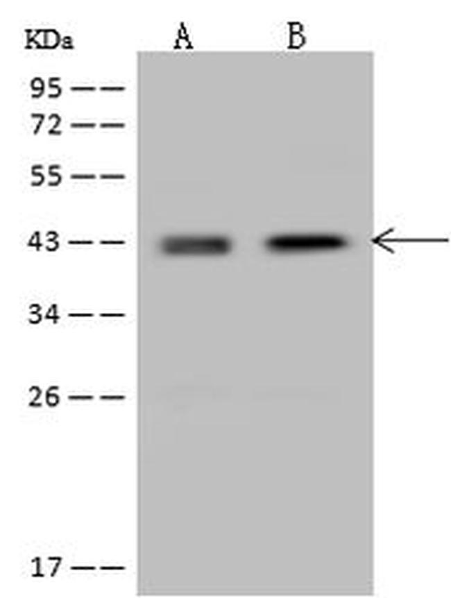 Nudel Antibody in Western Blot (WB)