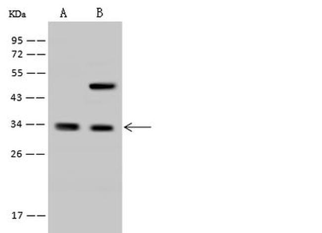 RFXANK Antibody in Western Blot (WB)