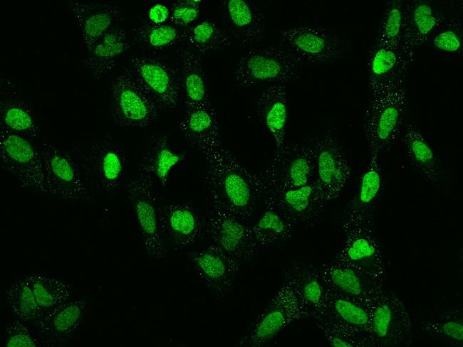 RNMT Antibody in Immunocytochemistry (ICC/IF)