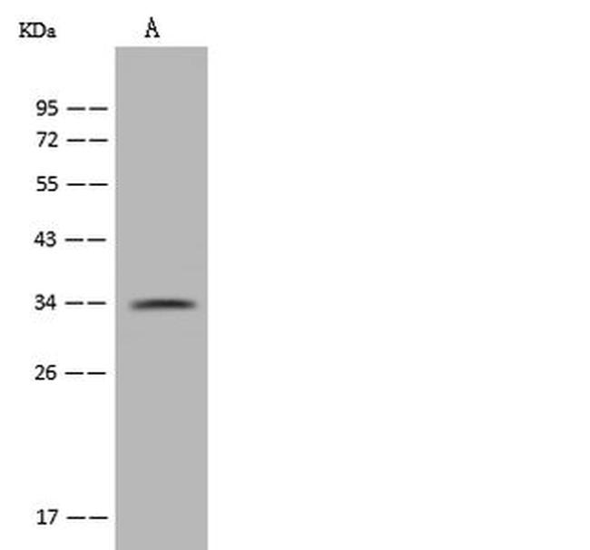 Parp16 Antibody in Western Blot (WB)