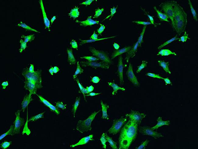 DENR Antibody in Immunocytochemistry (ICC/IF)