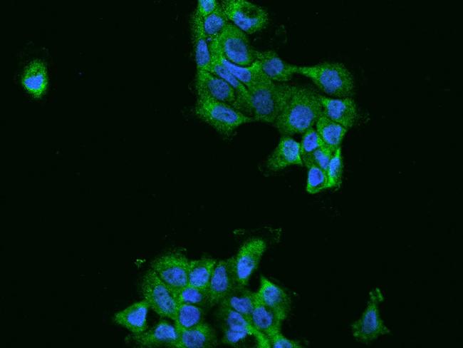 FARSA Antibody in Immunocytochemistry (ICC/IF)