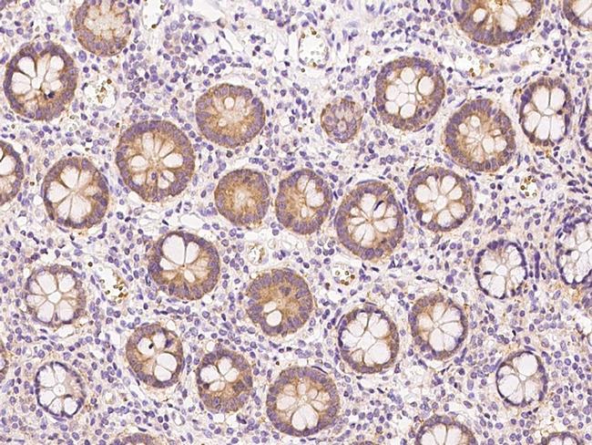 UMPS Antibody in Immunohistochemistry (Paraffin) (IHC (P))