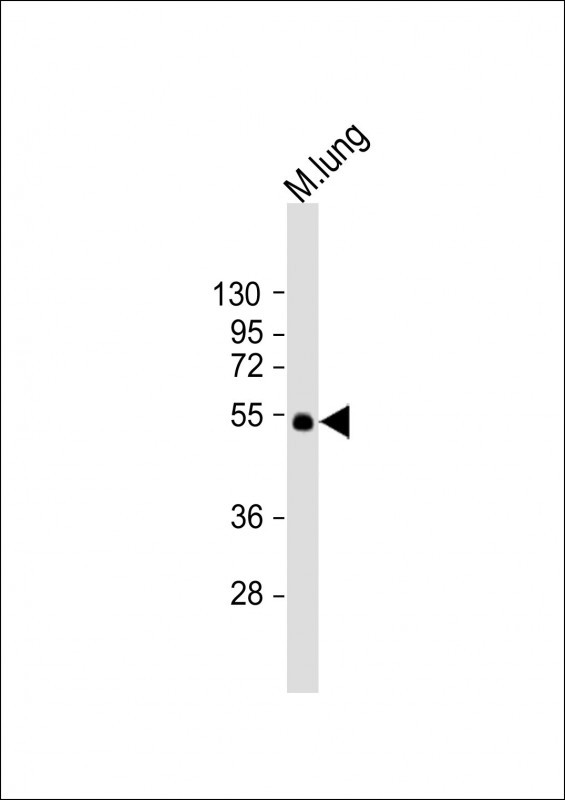 ENT1 Antibody in Western Blot (WB)