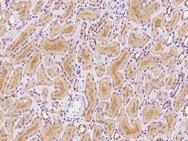 GLRB Antibody in Immunohistochemistry (Paraffin) (IHC (P))