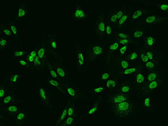 SLCO4C1 Antibody in Immunocytochemistry (ICC/IF)