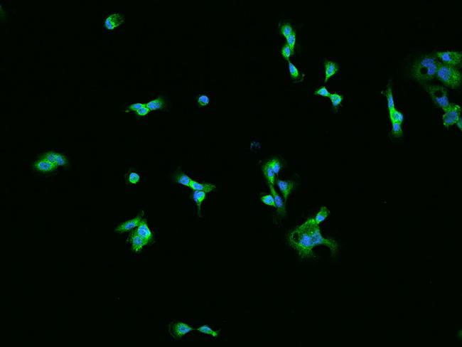 AdoHcyase 2 Antibody in Immunocytochemistry (ICC/IF)