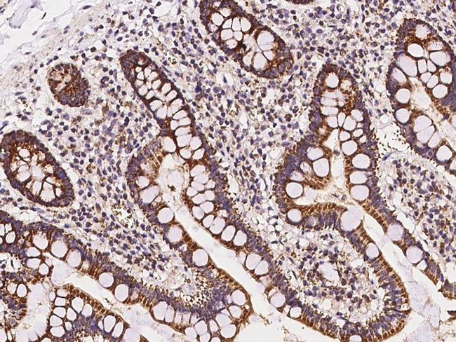 MRPL20 Antibody in Immunohistochemistry (Paraffin) (IHC (P))