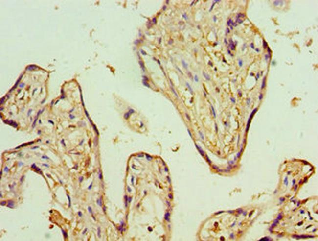 ADSS Antibody in Immunohistochemistry (Paraffin) (IHC (P))