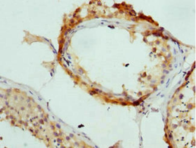 AP2A2 Antibody in Immunohistochemistry (Paraffin) (IHC (P))