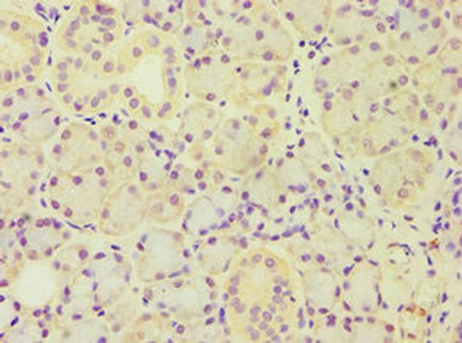 ARF3 Antibody in Immunohistochemistry (Paraffin) (IHC (P))