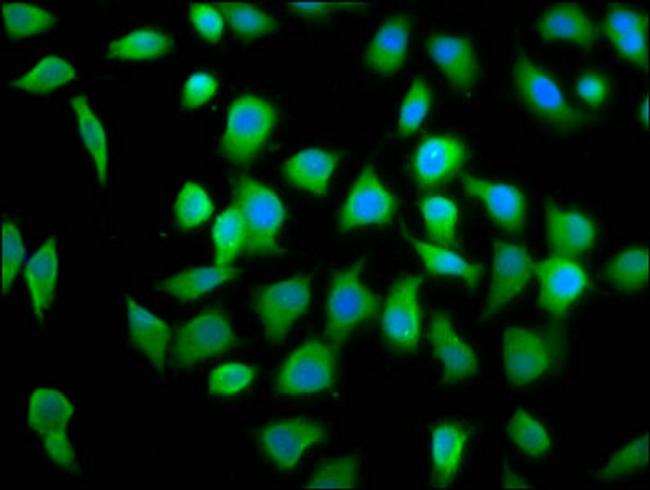 eIF4A2 Antibody in Immunocytochemistry (ICC/IF)