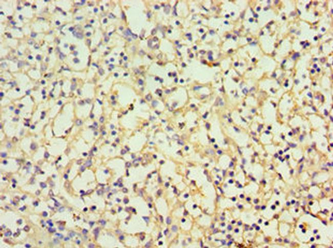 CBR3 Antibody in Immunohistochemistry (Paraffin) (IHC (P))