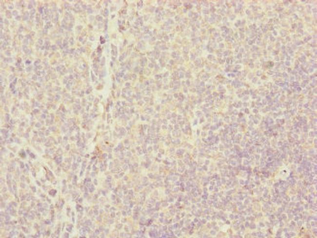 CENPH Antibody in Immunohistochemistry (Paraffin) (IHC (P))