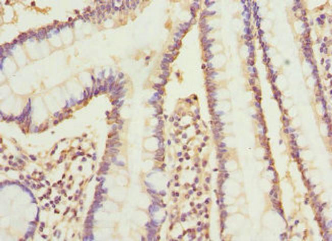 CYP2C18 Antibody in Immunohistochemistry (Paraffin) (IHC (P))