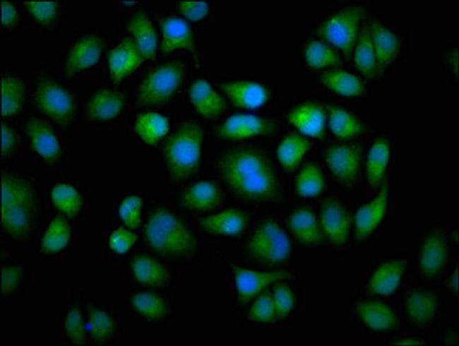 CYP2C19 Antibody in Immunocytochemistry (ICC/IF)