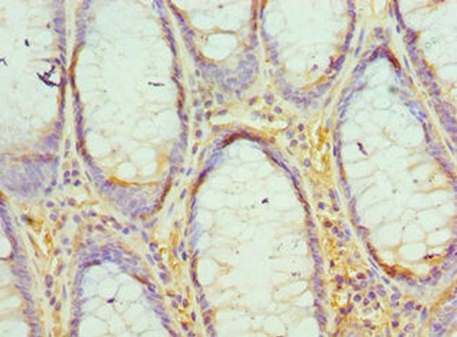 EED Antibody in Immunohistochemistry (Paraffin) (IHC (P))