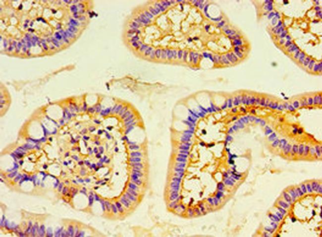 ENTPD5 Antibody in Immunohistochemistry (Paraffin) (IHC (P))