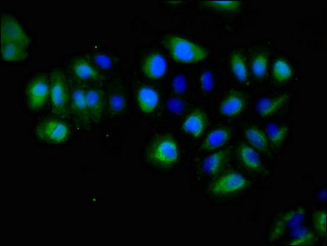 EphA5 Antibody in Immunocytochemistry (ICC/IF)