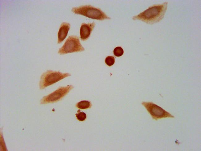 Formyl-Histone H1.2 (Lys109) Antibody in Immunocytochemistry (ICC/IF)