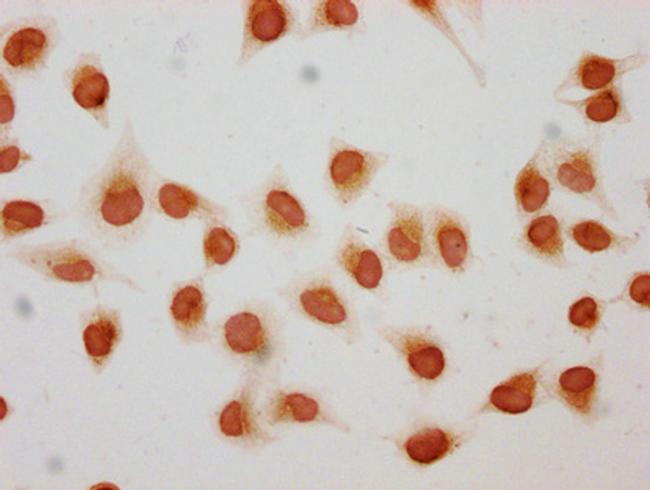 2-hydroxyisobutyryl-Histone H1.2 (Lys158) Antibody in Immunocytochemistry (ICC/IF)