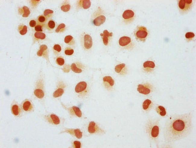 Mono-Methyl-Histone H1.2 (Lys45) Antibody in Immunocytochemistry (ICC/IF)