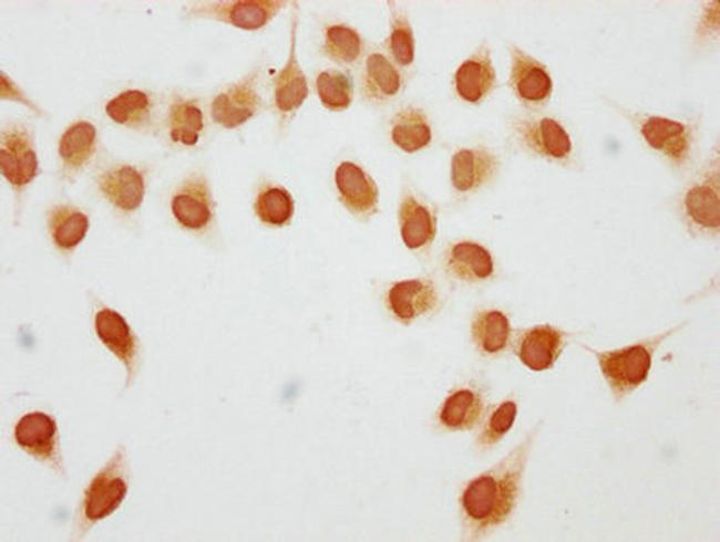 Acetyl-Histone H1.2 (Lys84) Antibody in Immunocytochemistry (ICC/IF)