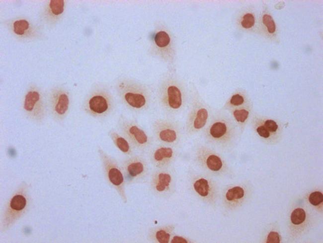 Formyl-Histone H1.2 (Lys96) Antibody in Immunocytochemistry (ICC/IF)