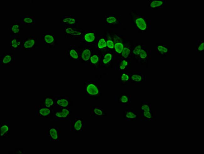 Phospho-Histone H1.4 (Thr17) Antibody in Immunocytochemistry (ICC/IF)