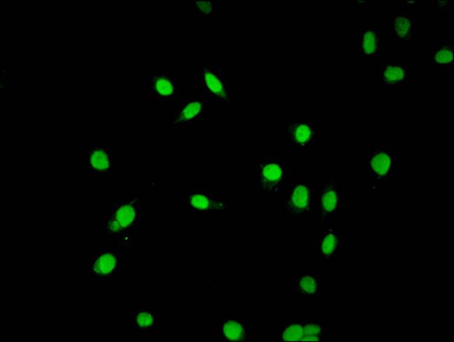 Acetyl-Histone Macro-H2A.1 (Lys9) Antibody in Immunocytochemistry (ICC/IF)