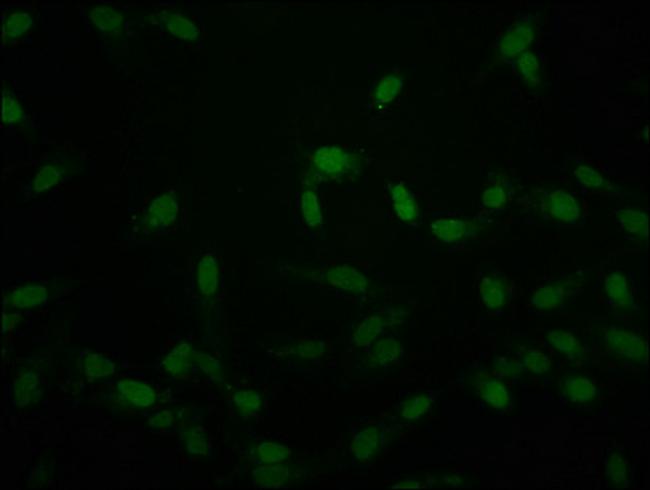 Crotonyl-Histone Macro-H2A.1 (Lys118) Antibody in Immunocytochemistry (ICC/IF)