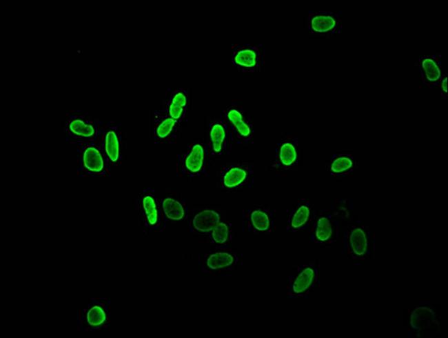 Acetyl-Histone Macro-H2A.1 (Lys36) Antibody in Immunocytochemistry (ICC/IF)