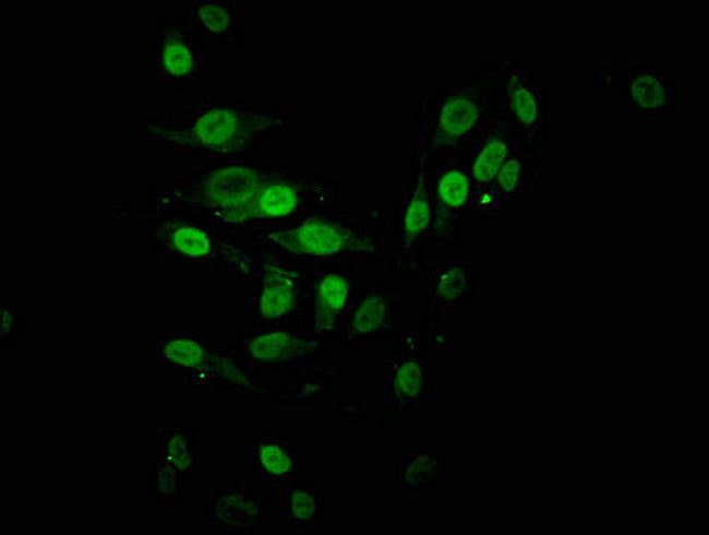 H2BK16ac Antibody in Immunocytochemistry (ICC/IF)