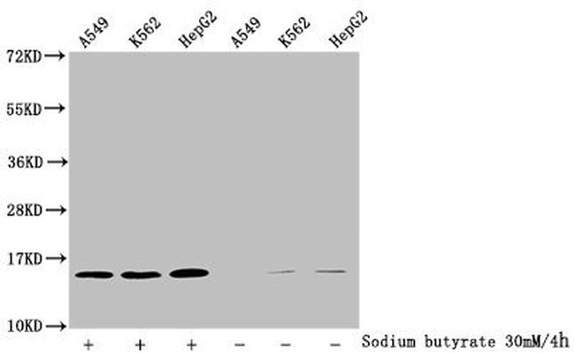 2-hydroxyisobutyryl-Histone H2B (Lys120) Antibody in Western Blot (WB)