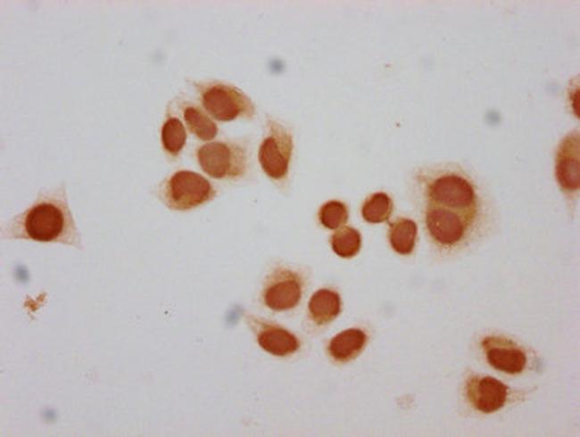 H2BK12me1 Antibody in Immunocytochemistry (ICC/IF)