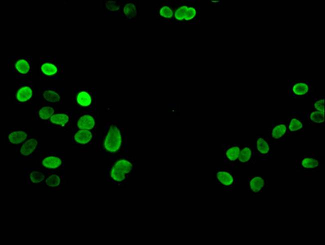 H3K27me3 Antibody in Immunocytochemistry (ICC/IF)