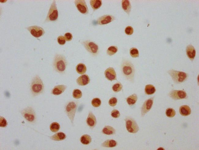 2-hydroxyisobutyryl-Histone H4 (Lys5) Antibody in Immunocytochemistry (ICC/IF)