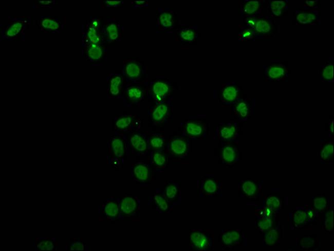 H4K91ac Antibody in Immunocytochemistry (ICC/IF)