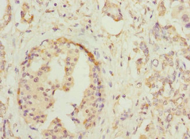 HOXD10 Antibody in Immunohistochemistry (Paraffin) (IHC (P))