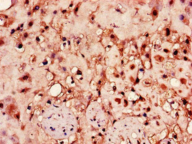 HPSE Antibody in Immunohistochemistry (Paraffin) (IHC (P))