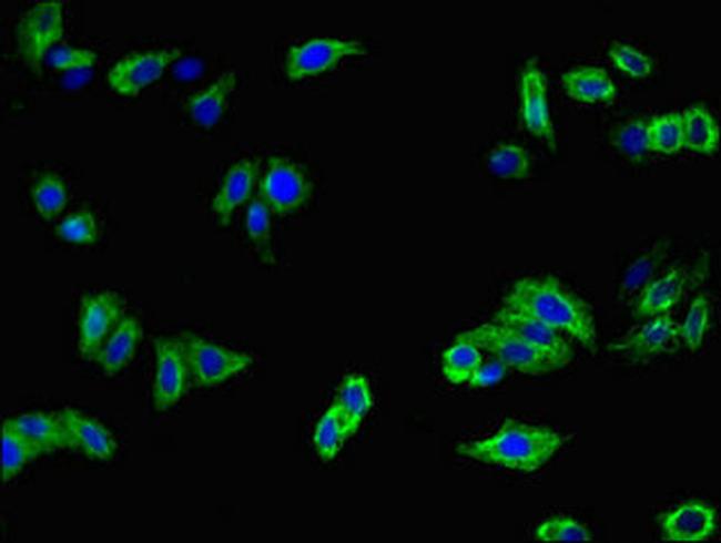 MFI2 Antibody in Immunocytochemistry (ICC/IF)