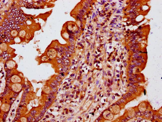 MTSS1 Antibody in Immunohistochemistry (Paraffin) (IHC (P))