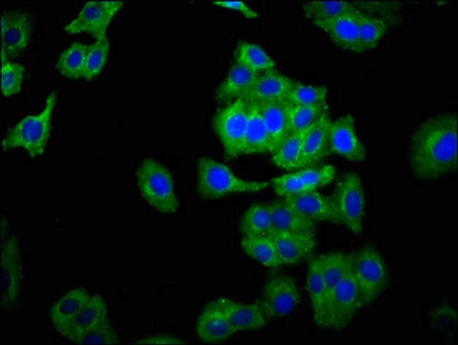 NCAM2 Antibody in Immunocytochemistry (ICC/IF)