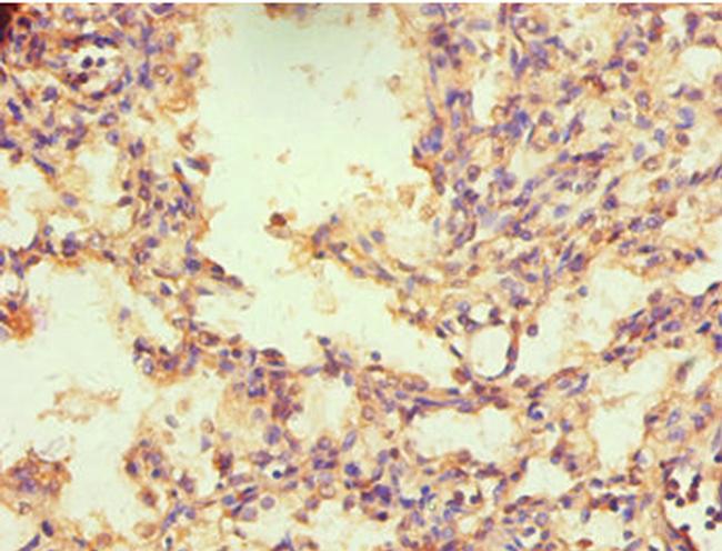 TR2 Antibody in Immunohistochemistry (Paraffin) (IHC (P))