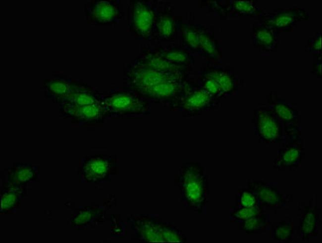 NTHL1 Antibody in Immunocytochemistry (ICC/IF)