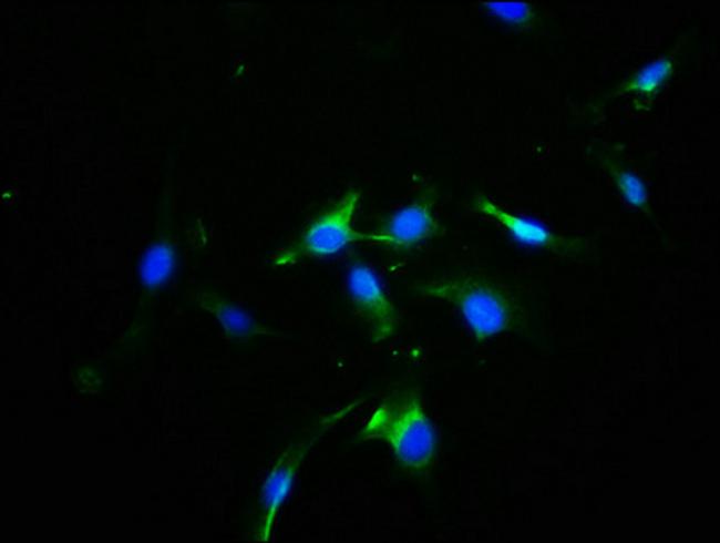 Opsin Blue Antibody in Immunocytochemistry (ICC/IF)